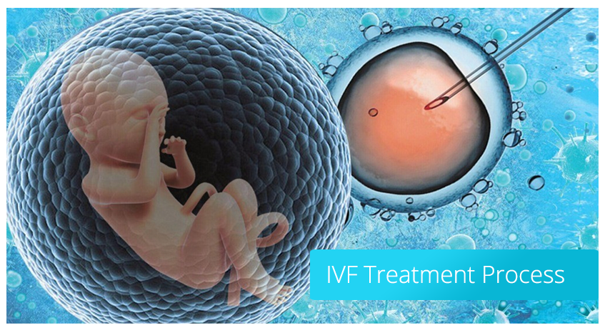 IVF