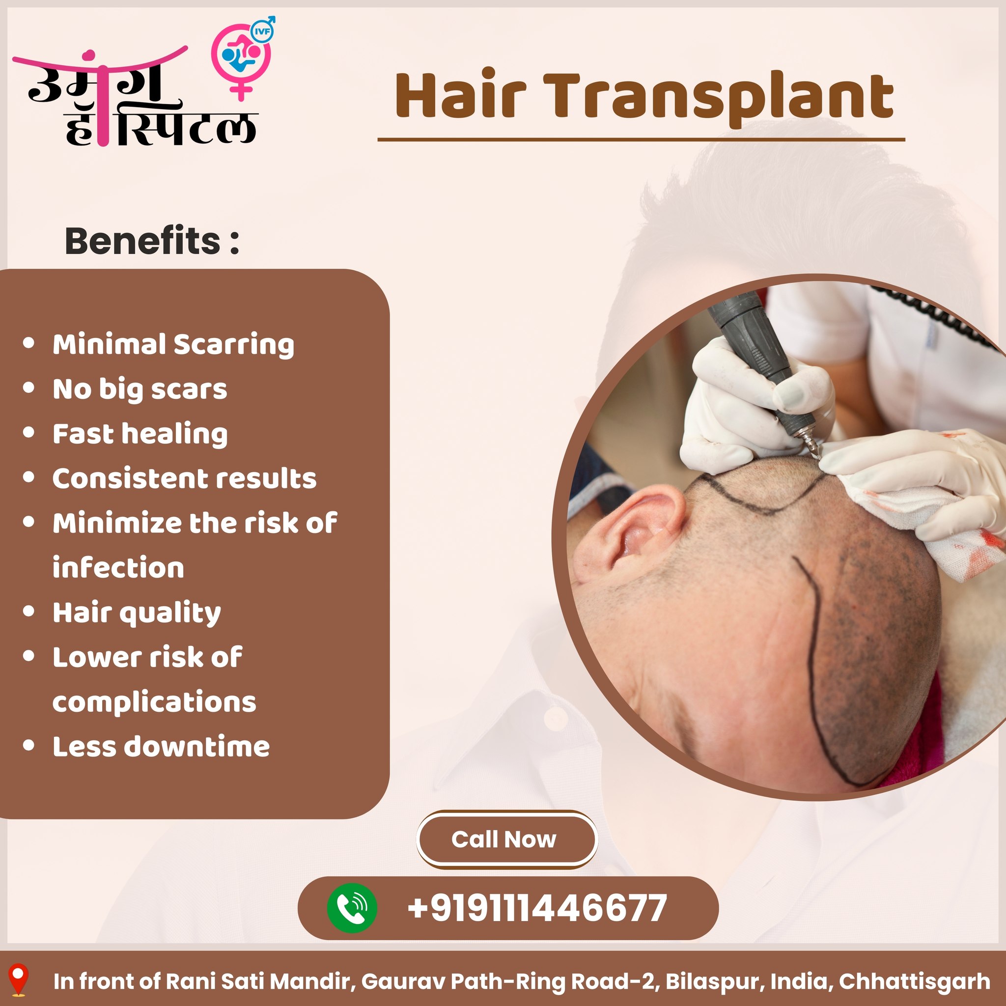 Hair Transplant