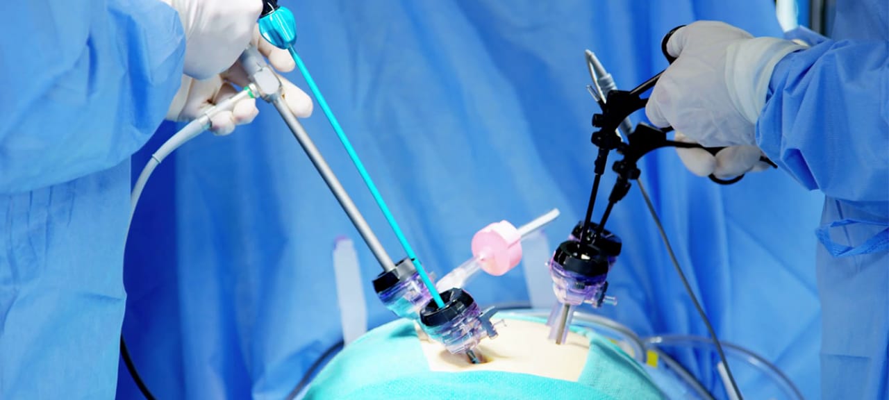 Advanced laparoscopic surgery