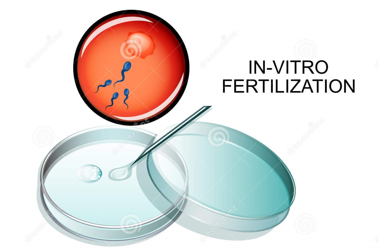 Test Tube Baby (IVF) Test and Treatment